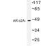 Adrenoceptor Alpha 2A antibody, LS-C176895, Lifespan Biosciences, Western Blot image 