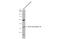 Alcohol Dehydrogenase 1B (Class I), Beta Polypeptide antibody, GTX114054, GeneTex, Western Blot image 