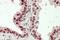 Homeobox D13 antibody, GTX88136, GeneTex, Immunohistochemistry paraffin image 