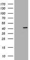 Mucin 16, Cell Surface Associated antibody, LS-C175581, Lifespan Biosciences, Western Blot image 