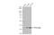 Protein Phosphatase 2 Catalytic Subunit Alpha antibody, GTX113523, GeneTex, Western Blot image 