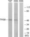 Transcription Factor EB antibody, LS-C118813, Lifespan Biosciences, Western Blot image 