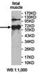 Zinc Finger Protein 195 antibody, orb78363, Biorbyt, Western Blot image 