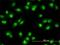 Nuclear Receptor Subfamily 1 Group D Member 2 antibody, H00009975-M01, Novus Biologicals, Immunofluorescence image 