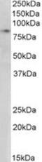 SET Domain Bifurcated Histone Lysine Methyltransferase 2 antibody, NB100-1137, Novus Biologicals, Western Blot image 