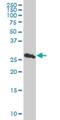 Proteasome Subunit Beta 10 antibody, H00005699-M01, Novus Biologicals, Western Blot image 