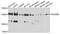 Eukaryotic Translation Initiation Factor 1A X-Linked antibody, A09001, Boster Biological Technology, Immunohistochemistry paraffin image 