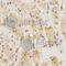 Proteasome Subunit Beta 5 antibody, A1975, ABclonal Technology, Immunohistochemistry paraffin image 