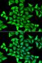 Sep (O-Phosphoserine) TRNA:Sec (Selenocysteine) TRNA Synthase antibody, LS-C334982, Lifespan Biosciences, Immunofluorescence image 