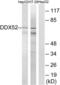 DExD-Box Helicase 52 antibody, LS-C120248, Lifespan Biosciences, Western Blot image 