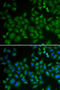 Sphingomyelin Phosphodiesterase 1 antibody, STJ28826, St John