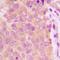 Extra Spindle Pole Bodies Like 1, Separase antibody, orb393048, Biorbyt, Immunohistochemistry paraffin image 