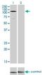 EPH receptor A3 antibody, H00002042-M01, Novus Biologicals, Western Blot image 