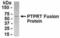 Protein Tyrosine Phosphatase Receptor Type T antibody, NB100-75300, Novus Biologicals, Western Blot image 