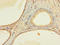 Zinc Finger Protein 432 antibody, A61950-100, Epigentek, Immunohistochemistry paraffin image 