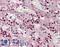 Cullin 3 antibody, LS-B12457, Lifespan Biosciences, Immunohistochemistry paraffin image 