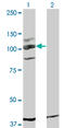 c-Kit antibody, LS-B6058, Lifespan Biosciences, Western Blot image 