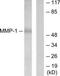 Matrix Metallopeptidase 1 antibody, TA313099, Origene, Western Blot image 
