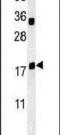 Trafficking Protein Particle Complex 6A antibody, PA5-25211, Invitrogen Antibodies, Western Blot image 