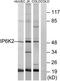Inositol Hexakisphosphate Kinase 2 antibody, TA315478, Origene, Western Blot image 