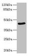 Serpin Family B Member 8 antibody, CSB-PA021076EA01HU, Cusabio, Western Blot image 