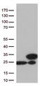 Transgelin 2 antibody, LS-C793124, Lifespan Biosciences, Western Blot image 