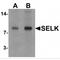 Selenoprotein K antibody, MBS151207, MyBioSource, Western Blot image 