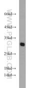TPD52 Like 2 antibody, 11795-1-AP, Proteintech Group, Western Blot image 