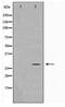 MOB Family Member 4, Phocein antibody, TA347760, Origene, Western Blot image 