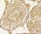 Placental Growth Factor antibody, NBP2-80390, Novus Biologicals, Immunohistochemistry paraffin image 