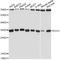 Enoyl-CoA Hydratase 1 antibody, LS-C748015, Lifespan Biosciences, Western Blot image 
