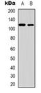 Zinc Finger CCCH-Type Containing 7B antibody, orb318961, Biorbyt, Western Blot image 