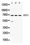 ATP Binding Cassette Subfamily E Member 1 antibody, PB10020, Boster Biological Technology, Western Blot image 