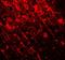 SWI/SNF Related, Matrix Associated, Actin Dependent Regulator Of Chromatin, Subfamily A, Member 4 antibody, GTX31917, GeneTex, Immunohistochemistry paraffin image 