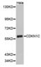 Cyclin Dependent Kinase Inhibitor 1C antibody, abx001677, Abbexa, Western Blot image 