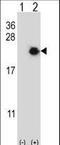 Eukaryotic Translation Initiation Factor 4E Binding Protein 1 antibody, LS-C167710, Lifespan Biosciences, Western Blot image 