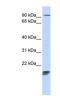 Mitochondrial Ribosomal Protein L58 antibody, NBP1-55014, Novus Biologicals, Western Blot image 