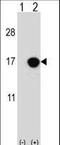 Cyclin Dependent Kinase Inhibitor 2B antibody, LS-C168624, Lifespan Biosciences, Western Blot image 