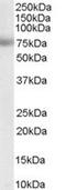 Metastasis Associated 1 antibody, LS-B4428, Lifespan Biosciences, Western Blot image 