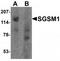 Small G Protein Signaling Modulator 1 antibody, TA320097, Origene, Western Blot image 