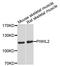 Piwi Like RNA-Mediated Gene Silencing 2 antibody, STJ111261, St John