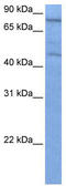 Zinc Finger Protein 555 antibody, TA345566, Origene, Western Blot image 