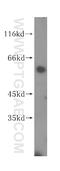 Kelch Domain Containing 4 antibody, 16915-1-AP, Proteintech Group, Western Blot image 