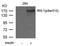 Insulin Receptor Substrate 1 antibody, NB100-81999, Novus Biologicals, Western Blot image 