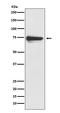 Tyrosinase antibody, M00326-1, Boster Biological Technology, Western Blot image 