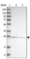 ATP Synthase Mitochondrial F1 Complex Assembly Factor 2 antibody, PA5-54767, Invitrogen Antibodies, Western Blot image 