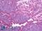 T-cell surface glycoprotein CD1c antibody, LS-B10059, Lifespan Biosciences, Immunohistochemistry frozen image 