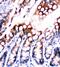 Fatty acid-binding protein, epidermal antibody, PA1853, Boster Biological Technology, Immunohistochemistry frozen image 