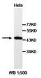 Amyloid Beta Precursor Protein Binding Family A Member 1 antibody, orb77070, Biorbyt, Western Blot image 