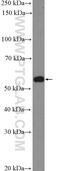 Nitric Oxide Synthase Trafficking antibody, 20116-1-AP, Proteintech Group, Western Blot image 